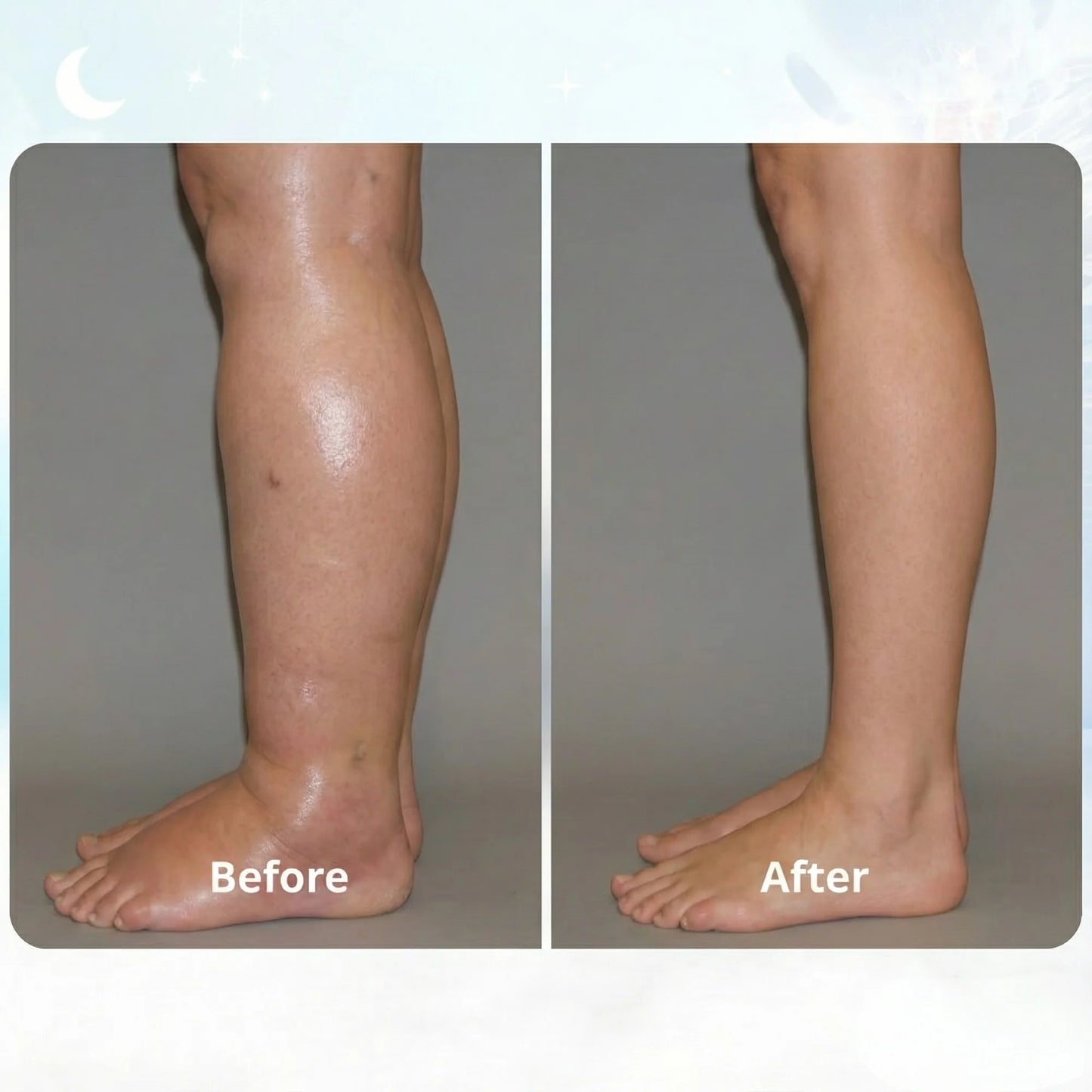 PulseStep by Somvexia™